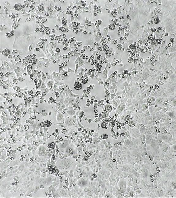 Omicron virus variants under microscope