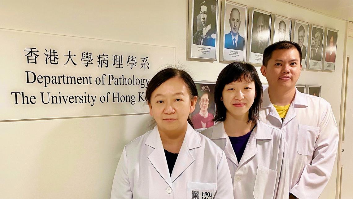 HKUMed 研究人員發現 ORF8 和 ORF3b 是 SARS-CoV-2 體液免疫反應的主要靶標,可用於更具體的 COVID-19 感染檢測